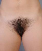 Atk Hairy